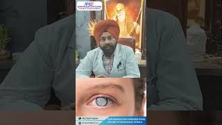 Understanding EDOF Lenses for Cataract with Dr Gurjeet Singh [upl. by Oniliuqnart557]