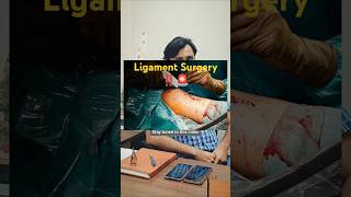 Ligament Surgery kis age group ko jyada jarurat hoti hai dailytips health doctor viralvideo [upl. by Glinys754]