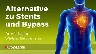 Strophanthin statt Stents  Bypass aber auch bei Stress  Dr med dent Wieland Debusmann  QS24 [upl. by Hermosa525]