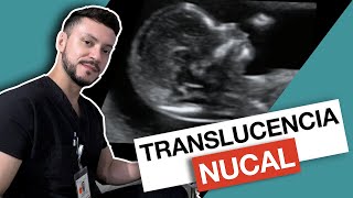 ¿Qué es la TRANSLUCENCIA NUCAL [upl. by Mcdade118]