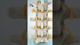 Understanding Intervertebral Discs amp Disc Herniation by Dr Abhijit Kulkarni  Brain amp Spine Surgeon [upl. by Olsewski754]