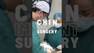 Chin augmentation goes beyond simple enhancement—it can also refine the lower third of the face [upl. by Adnaugal284]