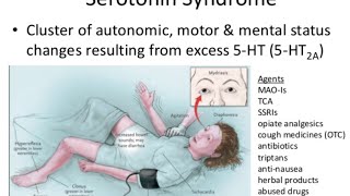 Serotonin Syndrome [upl. by Turnbull680]