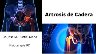 Rehabilitación en la Artrosis de Cadera Fisioterapia RD [upl. by Hamaso]