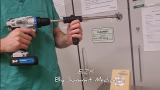 Acetabular Cup Removal Featuring EZX By Summit Medical Explants Total Hip Replacement Revision [upl. by Elleinnad]