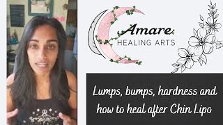 Lumps bumps hardness and how to heal after Chin Lipo [upl. by Ymiaj]