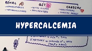 Hypercalcemia made easy definitionpathophysiologysymptomscomplicationsdiagnosismanagement [upl. by Stallworth730]