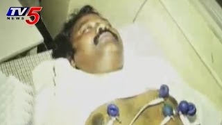 Congress Candidate Gajuwaka Sudhakar Naidu Attacked By Some Miscreants [upl. by Robi]