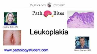 Path Bites  Vulvar Leukoplakia [upl. by Anig519]