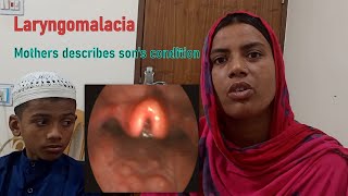 Laryngomalacia Laryngoscopy amp Clinical Feature। Natural History। Mother Describes Sons Condition [upl. by Ramona]