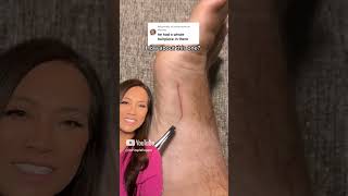 Dr Pimple Popper Reacts to Inflamed Ingrown That Looks SATISFYING to Pull Out [upl. by Sholeen759]