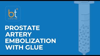 Course Preview Prostate Artery Embolization with Glue [upl. by Akeim]