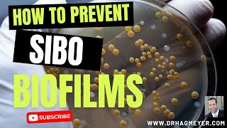 SIBO and Biofilms Why Biofilm Disruptors Are So Important When You Have SIBO [upl. by Eward]