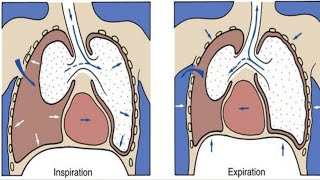 Pneumothorax amp hydropneumothorax  Chest Disease [upl. by Ylrad824]