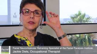 Neuromuscular Retraining for Facial Paralysis After Bells Palsy  Beverly Hills [upl. by Mitch]