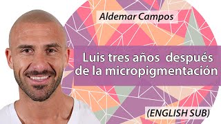 ⭐NOVEDAD⭐Micropigmentación Capilar después de 3 años Resultado asombroso ENGLISH SUB [upl. by Tracie]