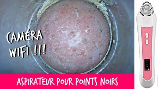 ASPIRATEUR POINTS NOIRS ET COMÉDONS AVEC UNE CAMÉRA HD [upl. by Annaohj]