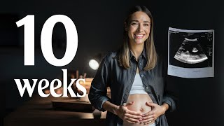 From Embryo to Fetus  The Magic of Week 10 Pregnancy [upl. by Irami640]