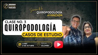 Quiropodologia casos de estudio 3 [upl. by Atinauj]