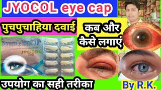 Jyocol eye caps ke fayde  chloramphenicol eye ointment uses in hindi  पुचपुचाहिया दवाई  jyocol [upl. by Annadroj]