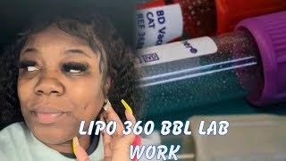 Lipo 360 BBL Lab Work [upl. by Aihsatsan]