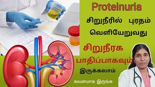 சிறுநீரில் புரதம் போவதால் காணப்படும் அறிகுறிகள் Proteinuria causes and symptoms [upl. by Eceinart]