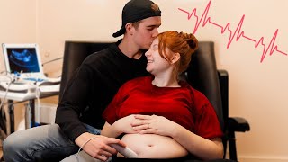 Hearing My Babys Heartbeat For The First Time 💕 [upl. by Nyrroc928]