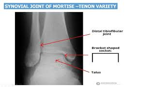 Ankle Joint Anatomy anatomy revision with questions and answers [upl. by Asiole]