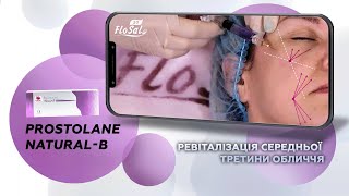 Ревіталізація середньої третини обличчя базовим ageмодулятором Prostrolane NaturalB💜 [upl. by Rodama]