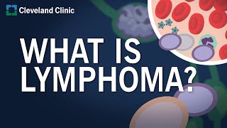 What Is Lymphoma [upl. by Malha]