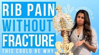 Rib Pain Without a Fracture Causes Symptoms and Treatment Options Explained [upl. by Lagas355]