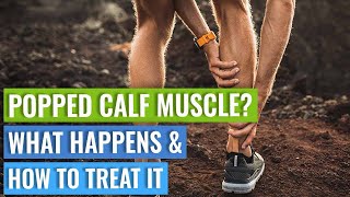 Pop In The Calf Muscle  What Happens amp How To Treat It [upl. by Leakcim]