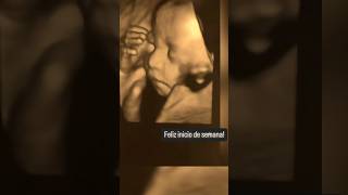 Bienvenido diciembre videos ecography medicina embarazo iniciodesemana lunes obstetrícia [upl. by Mela]