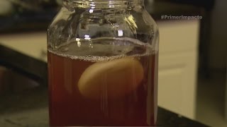 Los beneficios de la Kombucha podrían cambiar tu vida [upl. by Aiuqal284]