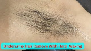 Underarms Hair Remove With Hard Waxing Summer waxing tutorialBeauty Tips By Geetu [upl. by Aissert]