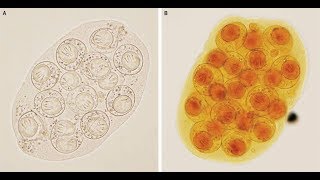 DipylidiumCaninum Infektion mit Gurkenkernbandwurm [upl. by Ynnaj827]