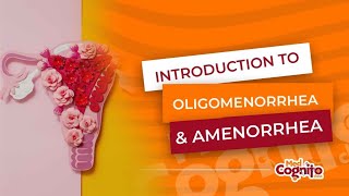 Introduction to Oligomenorrhea amp Amenorrhea  MCCQE1 [upl. by Littlejohn]