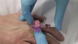 Cannulation How to insert a cannula One Minute Edition Medicine in a Nutshell IV Access [upl. by Jayson]