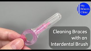 Cleaning Braces with an Interdental Brush [upl. by Latsyk]