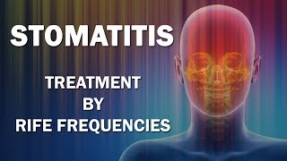 Stomatitis  RIFE Frequencies Treatment  Energy amp Quantum Medicine with Bioresonance [upl. by Philender]