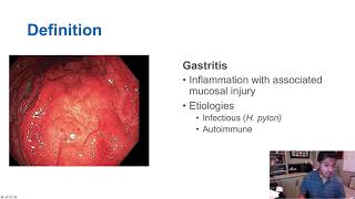 Gastritis vs Gastropathy [upl. by Enelhtak]