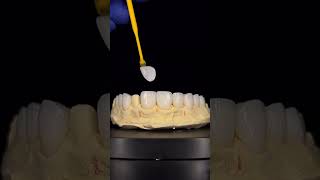 Crowns Vs Veneers  Difference Between Crowns amp Veneers  Smile Makeover [upl. by Einnor]