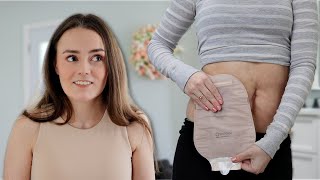 An Ostomy Appliance with the MOST Unique Feature  Lets Talk IBD [upl. by Lewap]