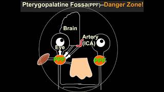 International Cancer Imaging Society course Oct 17 MRI in Nasopharyngeal carcinoma A King [upl. by Anyk]