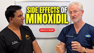 Side Effects of Minoxidil [upl. by Ayotahc]