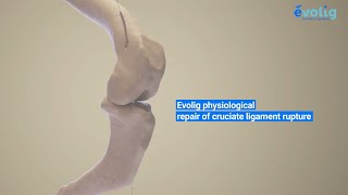 Evolig The Revolution in Veterinary Orthopedics  Cruciate Ligament Surgery Explained [upl. by Anauqed]