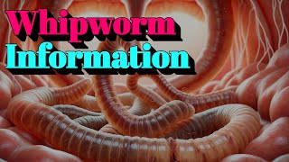 Whipworm Information 🔬Tier4 Infectious Disease [upl. by Wiseman]