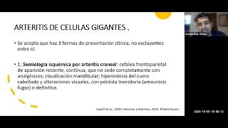 Arteritis de Células Gigantes [upl. by Aicram]