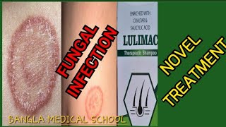 Chronic fungal infection Novel treatment of fungal infection দীর্ঘ মেয়াদি ফাংগাল ইনফেকশন। [upl. by Bonnibelle]