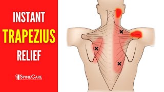 How to Relieve Trapezius Pain FOR GOOD [upl. by Hanson]